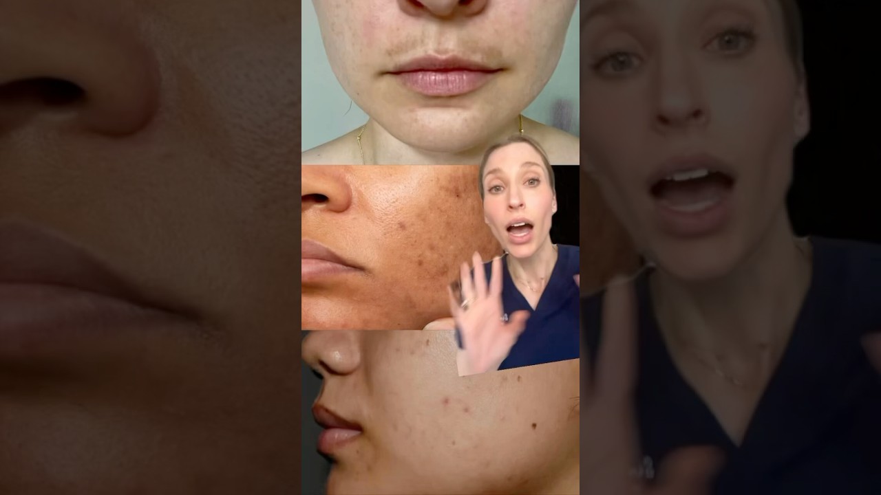 BEST products for hyperpigmentation. Use code DRSAM for 20% off the Dermstore sale