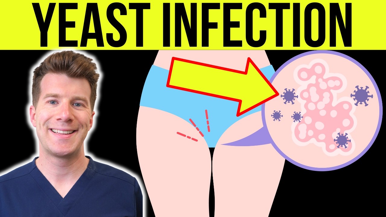 Doctor explains YEAST INFECTION (CANDIDA/THRUSH) in men and women | Causes, Symptoms, Treatment
